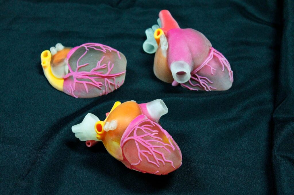 Global 3D Printed Surgical Models Industry