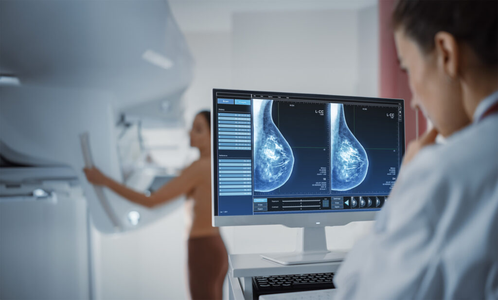 Global Breast Imaging Industry