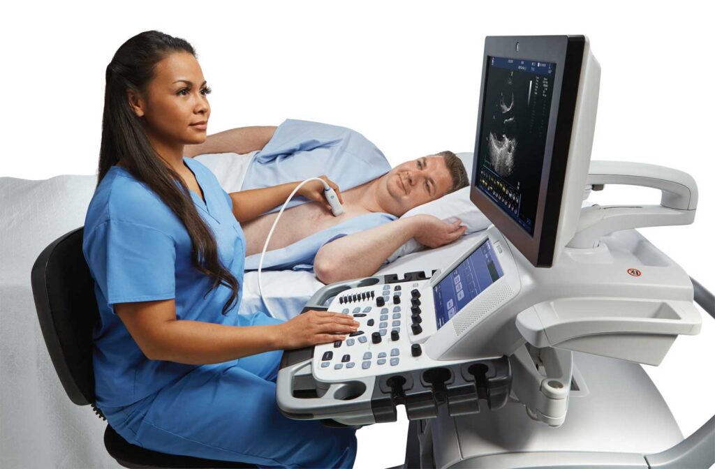 Global Cardiovascular Ultrasound Industry