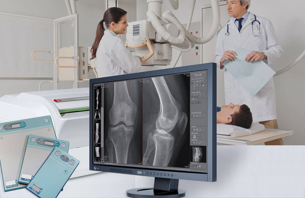 Global Diagnostic X-Ray System Market