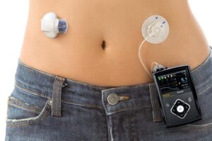 Insulin Pump Market