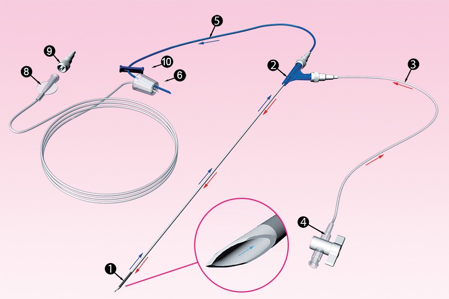 Oocyte Retrieval Needles Market