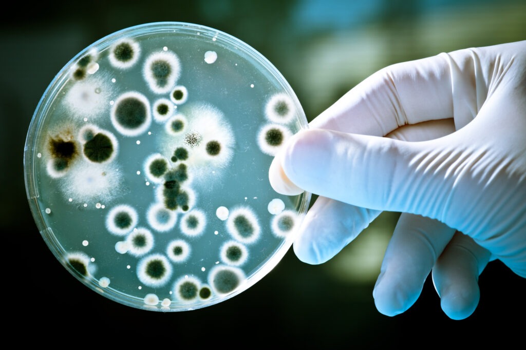 Antimicrobial Nanocoatings Market