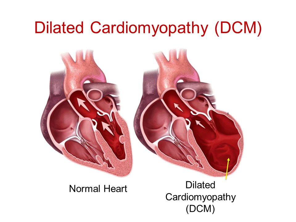 Canine Dilated Cardiomyopathy Drugs Market