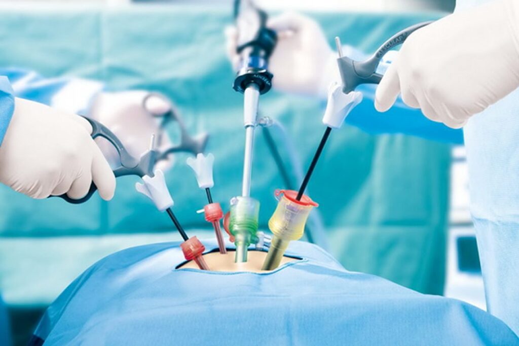 Bariatric Surgery Devices Market