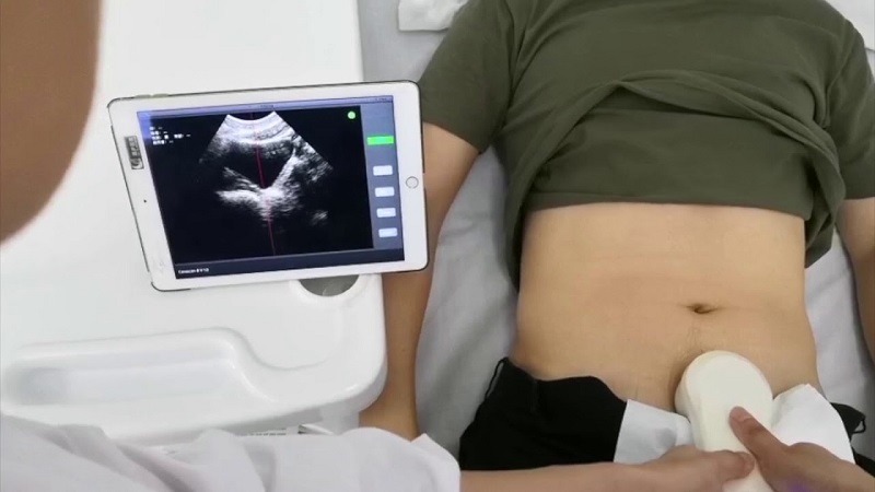 Portable Ultrasound Bladder Scanner Market