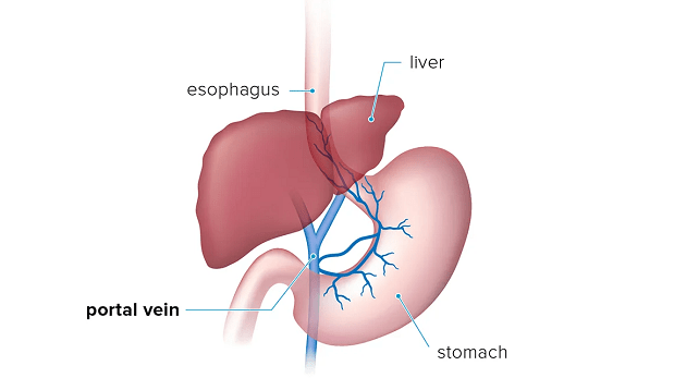 Portal Hypertension Management Market