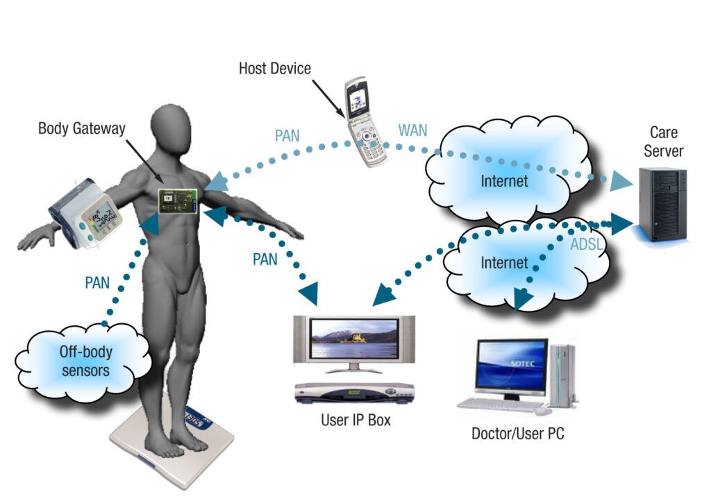 Tip Location Device Market