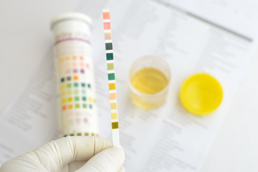 Genomic Urine Testing Market