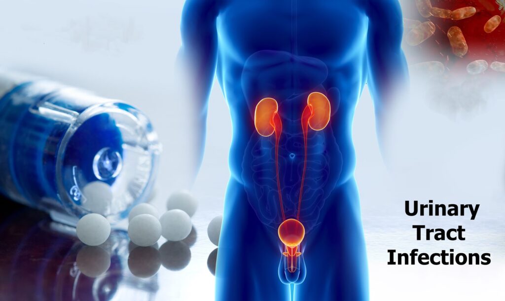 Global Urinary Tract Infection Treatment Industry