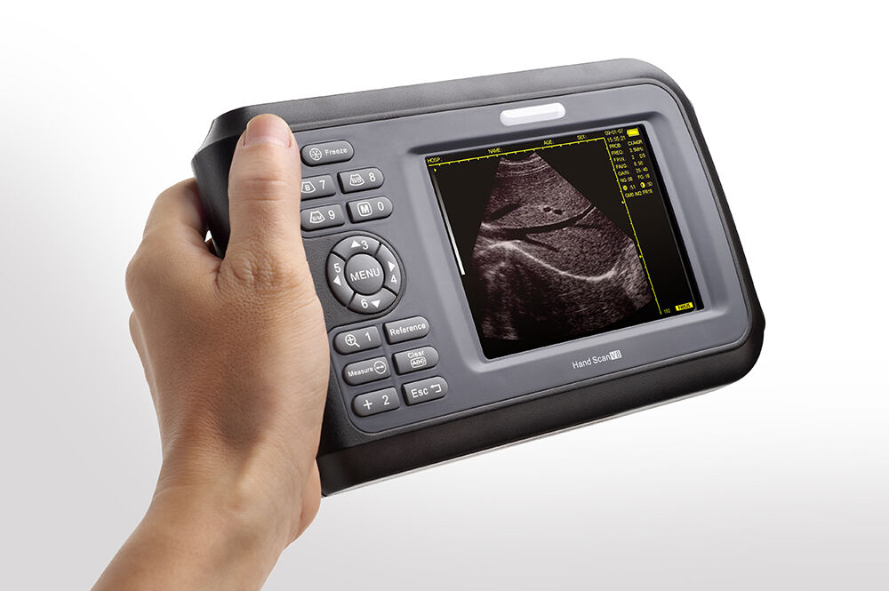 Handheld Ultrasound Scanner