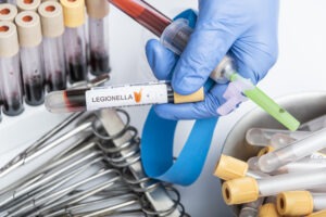 Legionella Testing Market