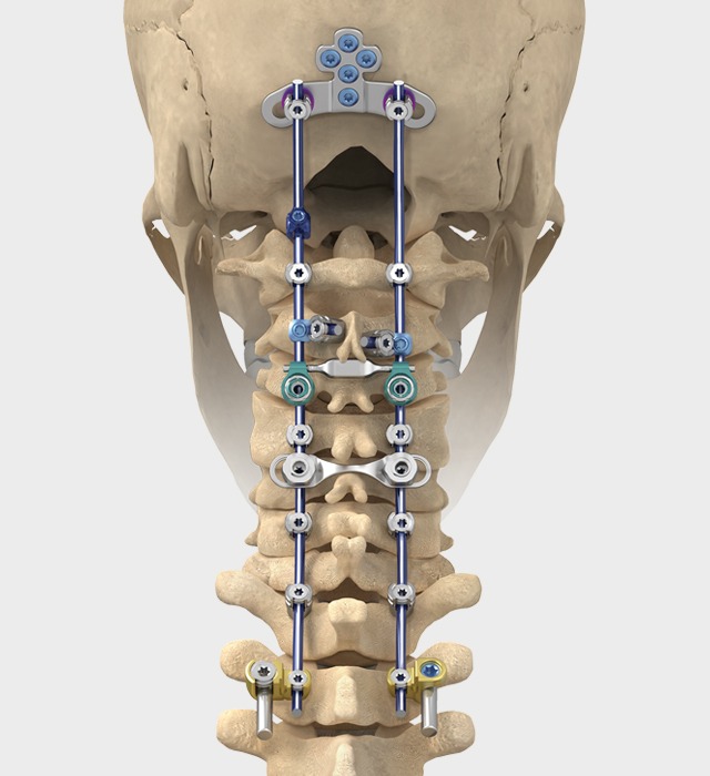 Cervical Spacer Systems Market 