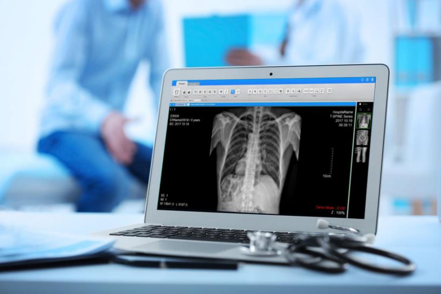 Digital Radiography Detectors Market