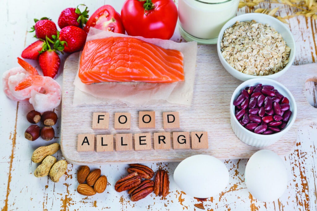 Food Allergy Market