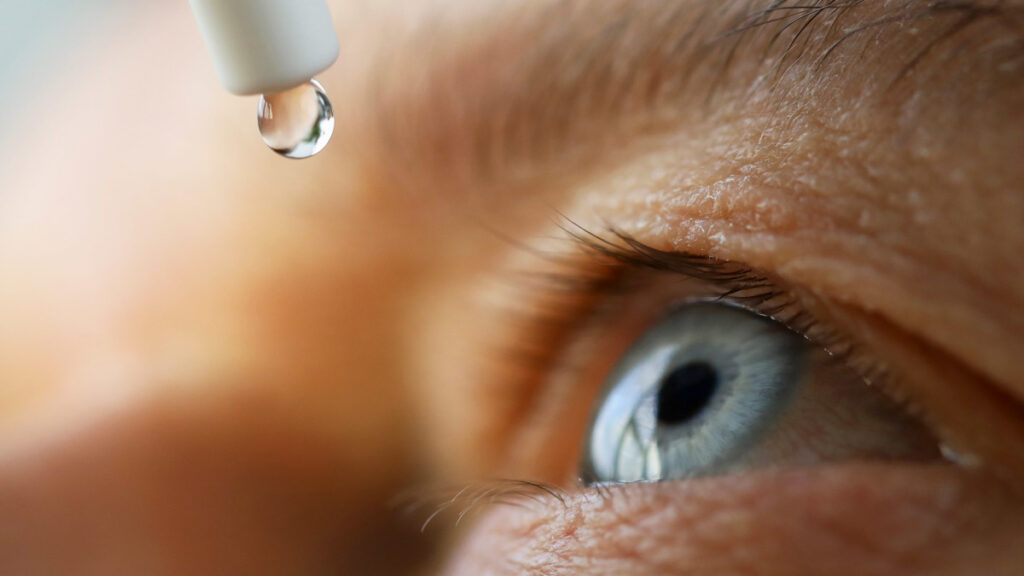 Dry Eye Syndrome (DES) Treatment Market