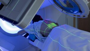 Image-Guided Radiotherapy Market