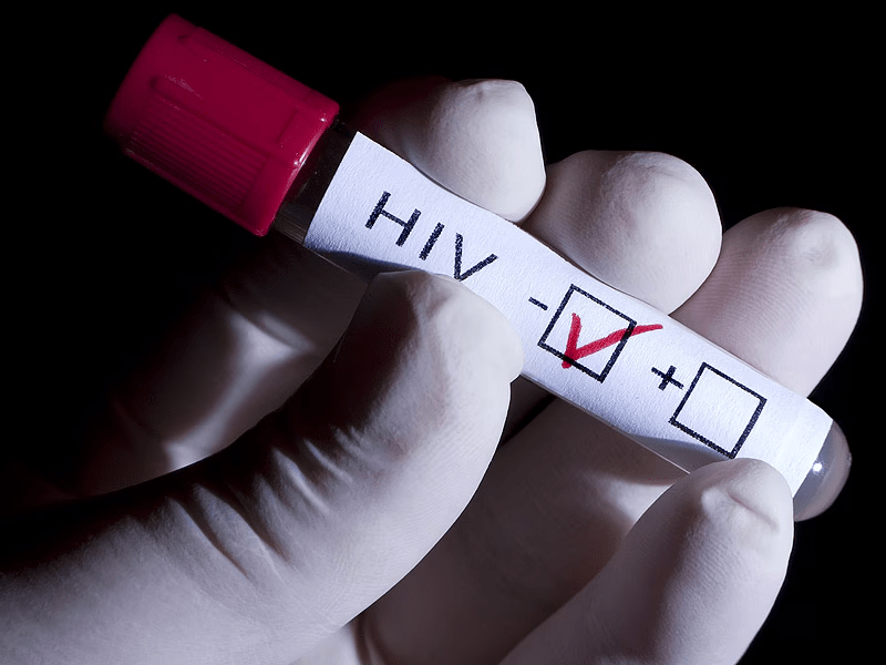 HIV Diagnostics Market